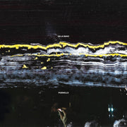 Gilla Band – Pugnello (Black LP Vinyl)